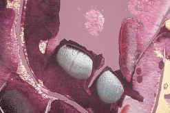 Impression sur toile violet feuilles cm 80x3x120-Mauro Ferretti New